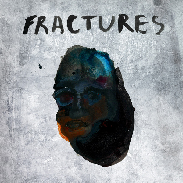 Fractures – Fractures