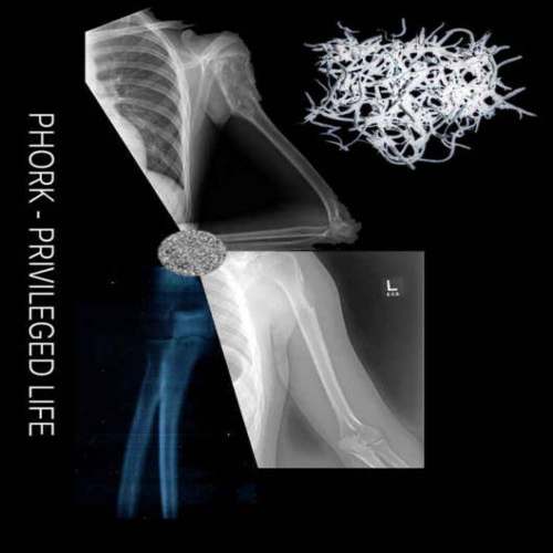 Phork – Privileged Life